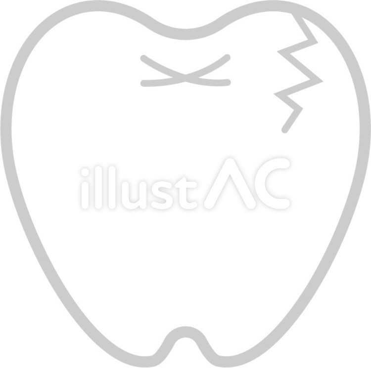 歯のひび01
